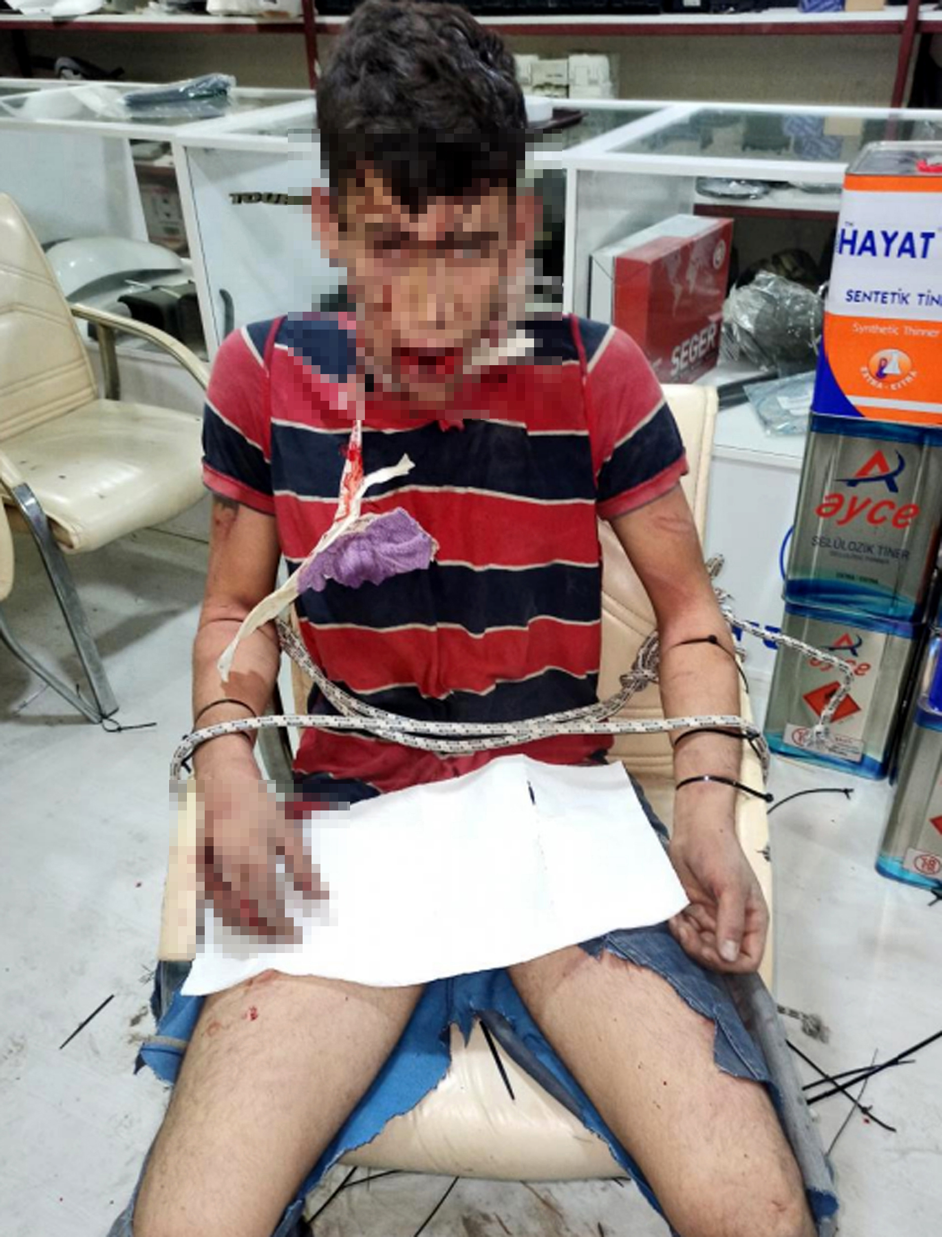 Antalya- Böcek yedirip, dişlerini kırdılar; savcı 20'şer yıl hapis istedi