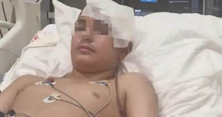 Konya'da  13  yaşındaki öğrenci okul arkadaşı tarafından taşla kafasından vurularak ağır şekilde yaralandı.