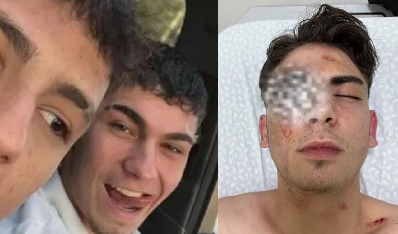 Konya'da Gözünü Kör Eden Darp Olayında Flaş Gelişme: Tahliye Edilen 2 Şüpheli Yeniden Gözaltında