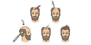 En İyi 10 Saç Ekimi Kliniği (2026) – Yeni Yılda Saçlarınıza Yatırım Yapmanın Tam Zamanı