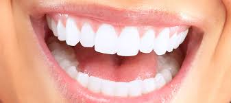 Hollywood Smile Nedir?