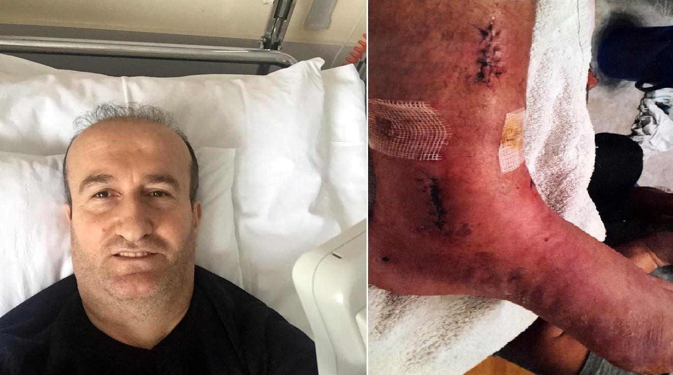 Arkeolojik kazı alanındaki çukura düşünce ayağında yüzde 3'lük engel oluştu; 1 milyon lira tazminat kararı çıktı