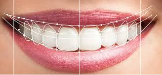 Dijital Gülüş Tasarımı Nedir?