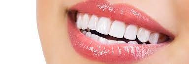 Ataşehir Diş Beyazlatma