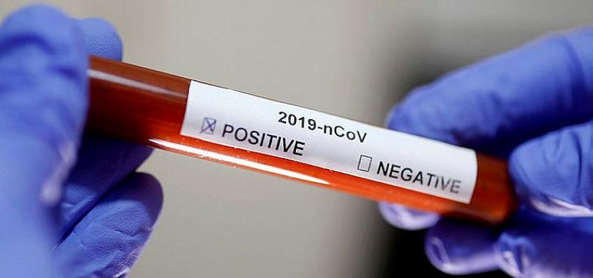 Corona virüste vaka sayıları neden yükseliyor?