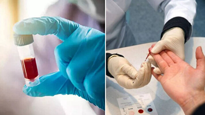 Kan grubunuzun şifresi çözüldü: O özellik dikkat çekti