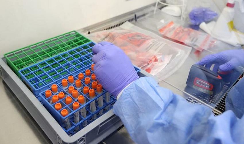 Koronavirüste Delta varyant nedir? Uzman isim açıkladı