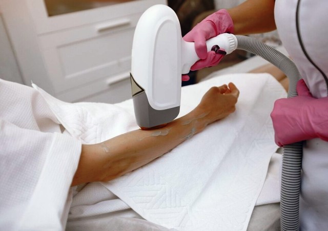 Lazer Epilasyon Teknolojisinde Kaliteli ve Güvenilir Seçimler