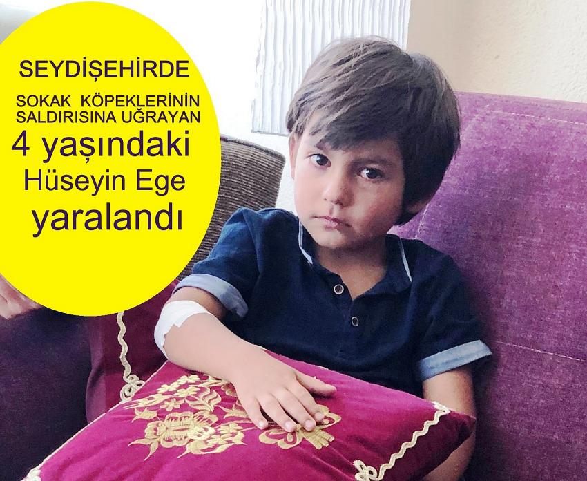 Seydişehir'de Sokak  köpekleri 4 yaşındaki çocuğa saldırdı 