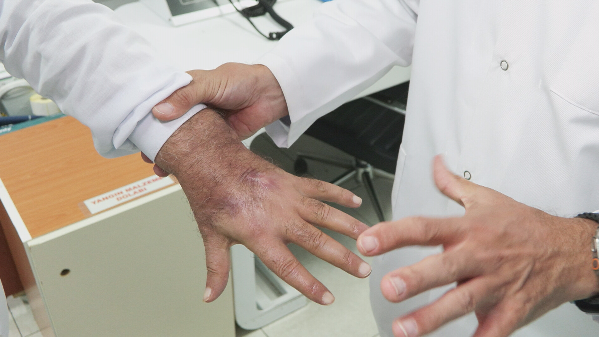 İstanbul - Hırsızın ısırığı kolundan ediyordu; vaka literatüre girmeye aday  - Görsel 5