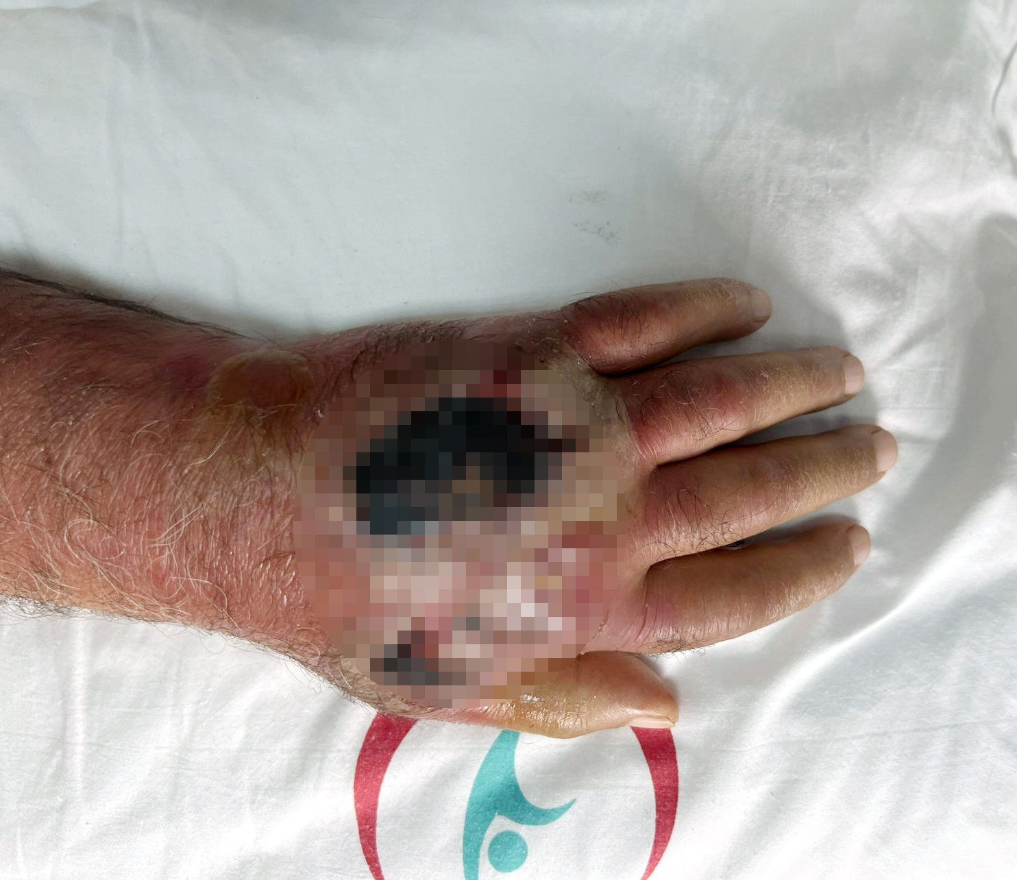 İstanbul - Hırsızın ısırığı kolundan ediyordu; vaka literatüre girmeye aday  - Görsel 7