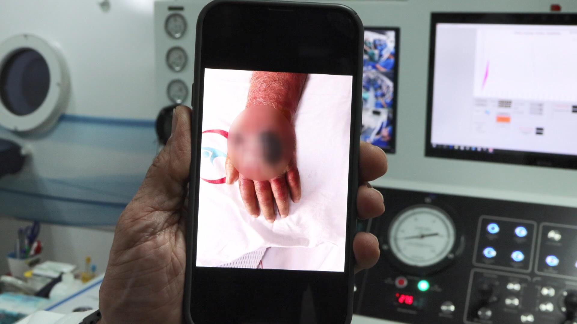 İstanbul - Hırsızın ısırığı kolundan ediyordu; vaka literatüre girmeye aday  - Görsel 9