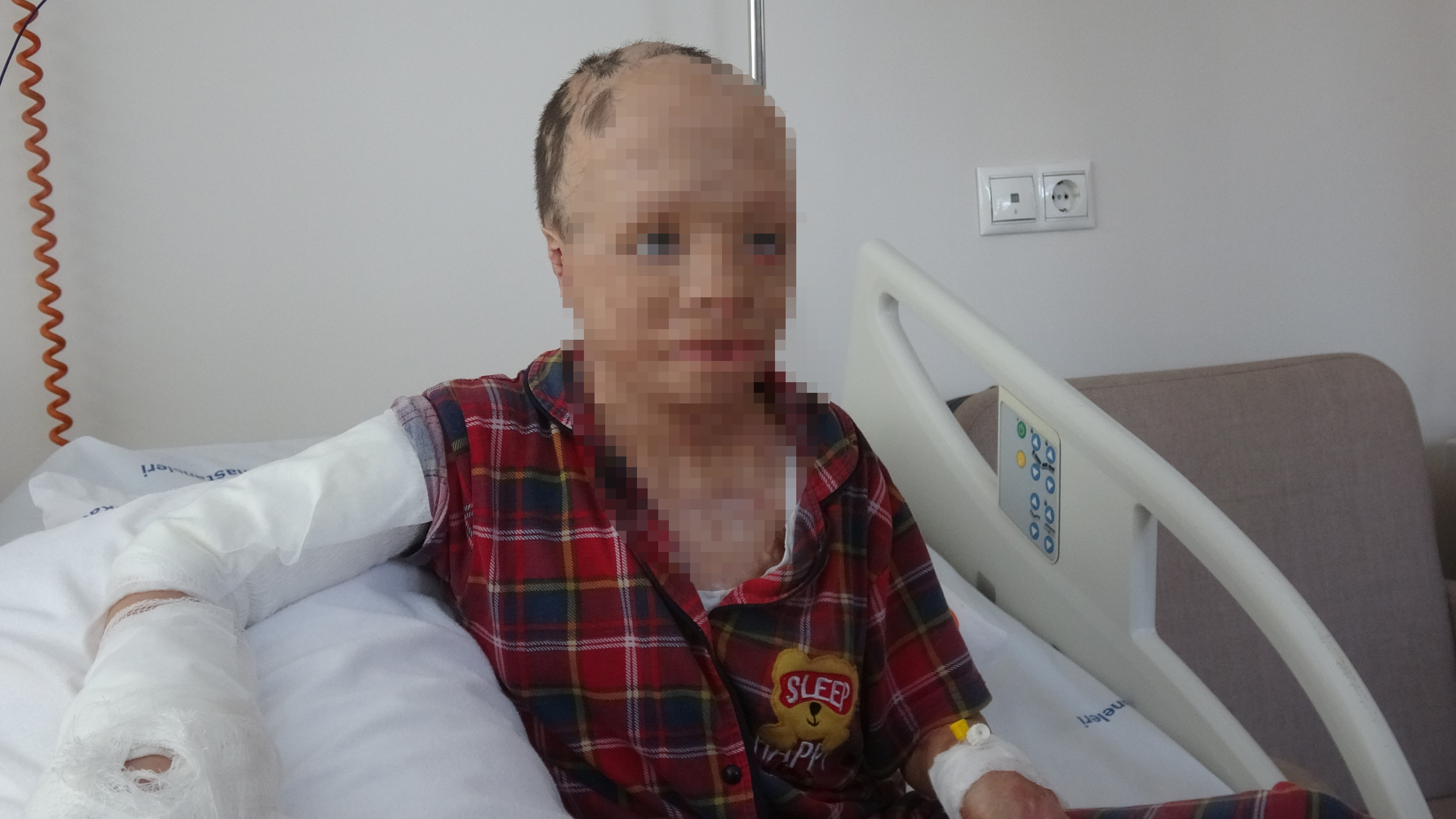 Konya - Babası ve 3 kardeşinin öldüğü yangında yaralanan Eymen, artık bir elini kullanabilecek - Görsel 1