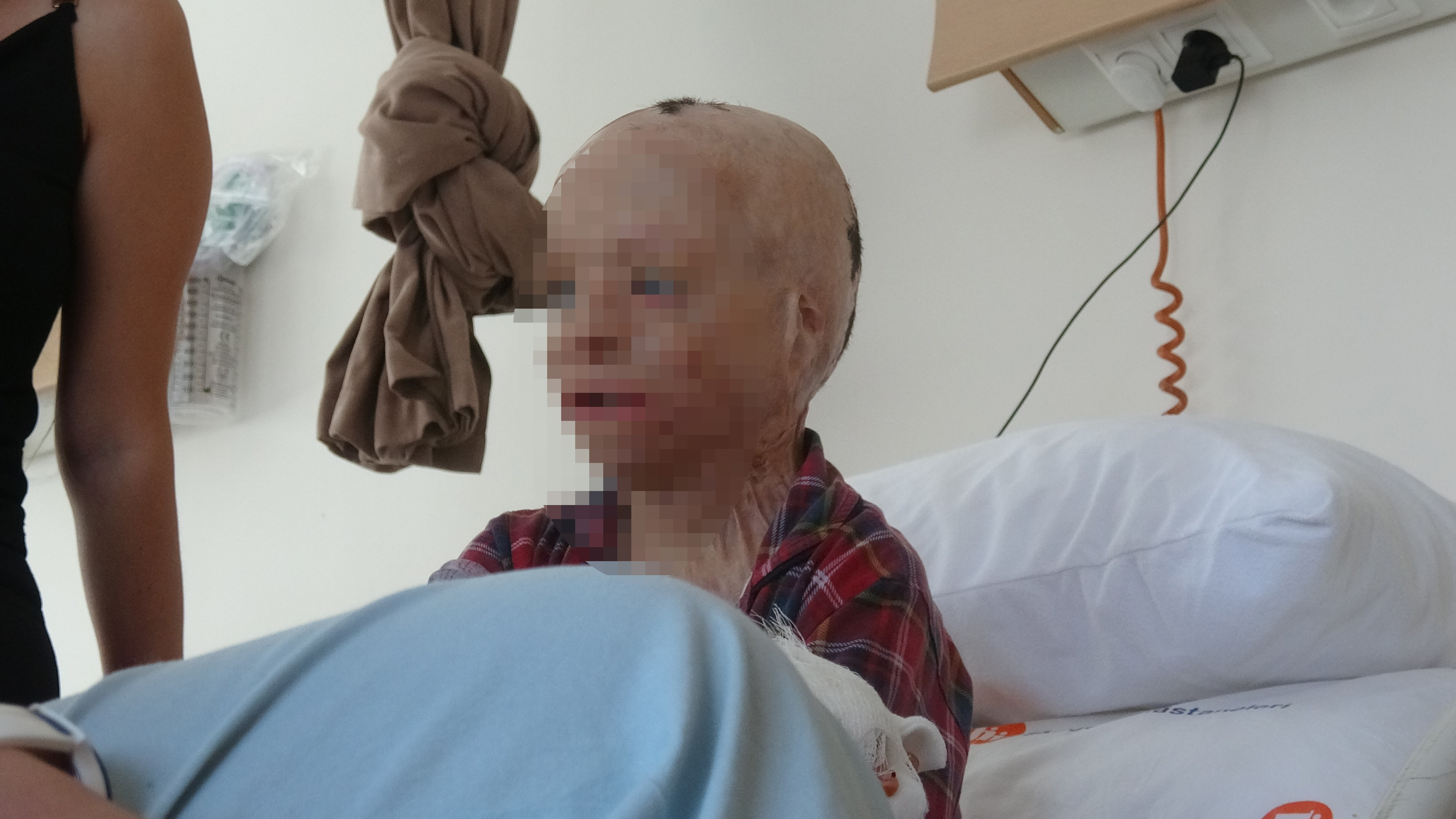 Konya - Babası ve 3 kardeşinin öldüğü yangında yaralanan Eymen, artık bir elini kullanabilecek - Görsel 4