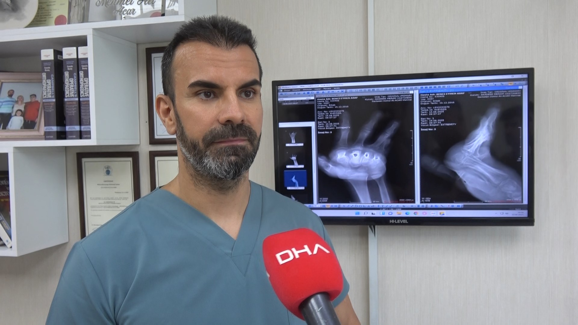 Konya - Babası ve 3 kardeşinin öldüğü yangında yaralanan Eymen, artık bir elini kullanabilecek - Görsel 5