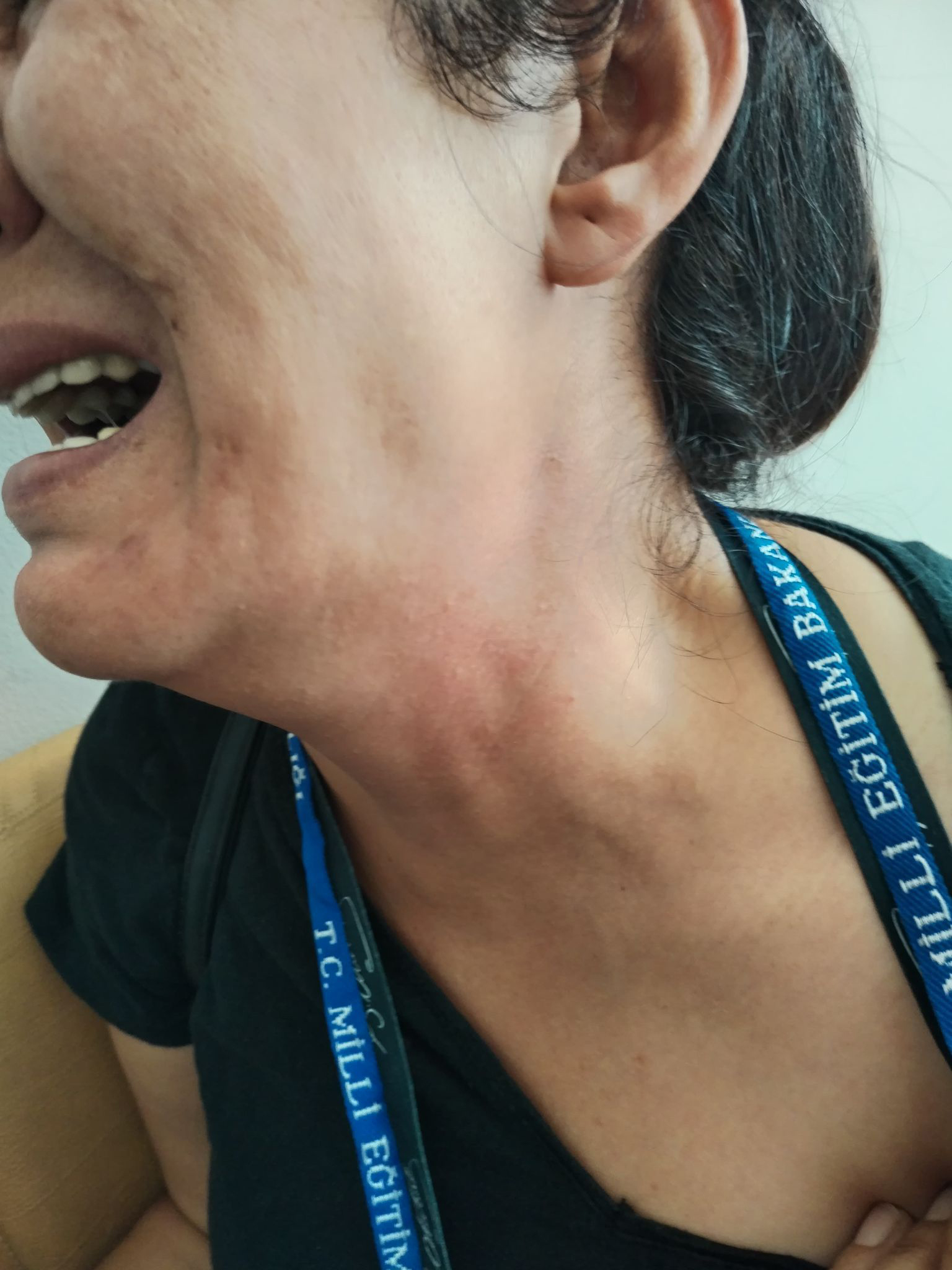 Antalya- Öğretmene tokat atan veli tutuklandı; saldırı anı kamerada - Görsel 3