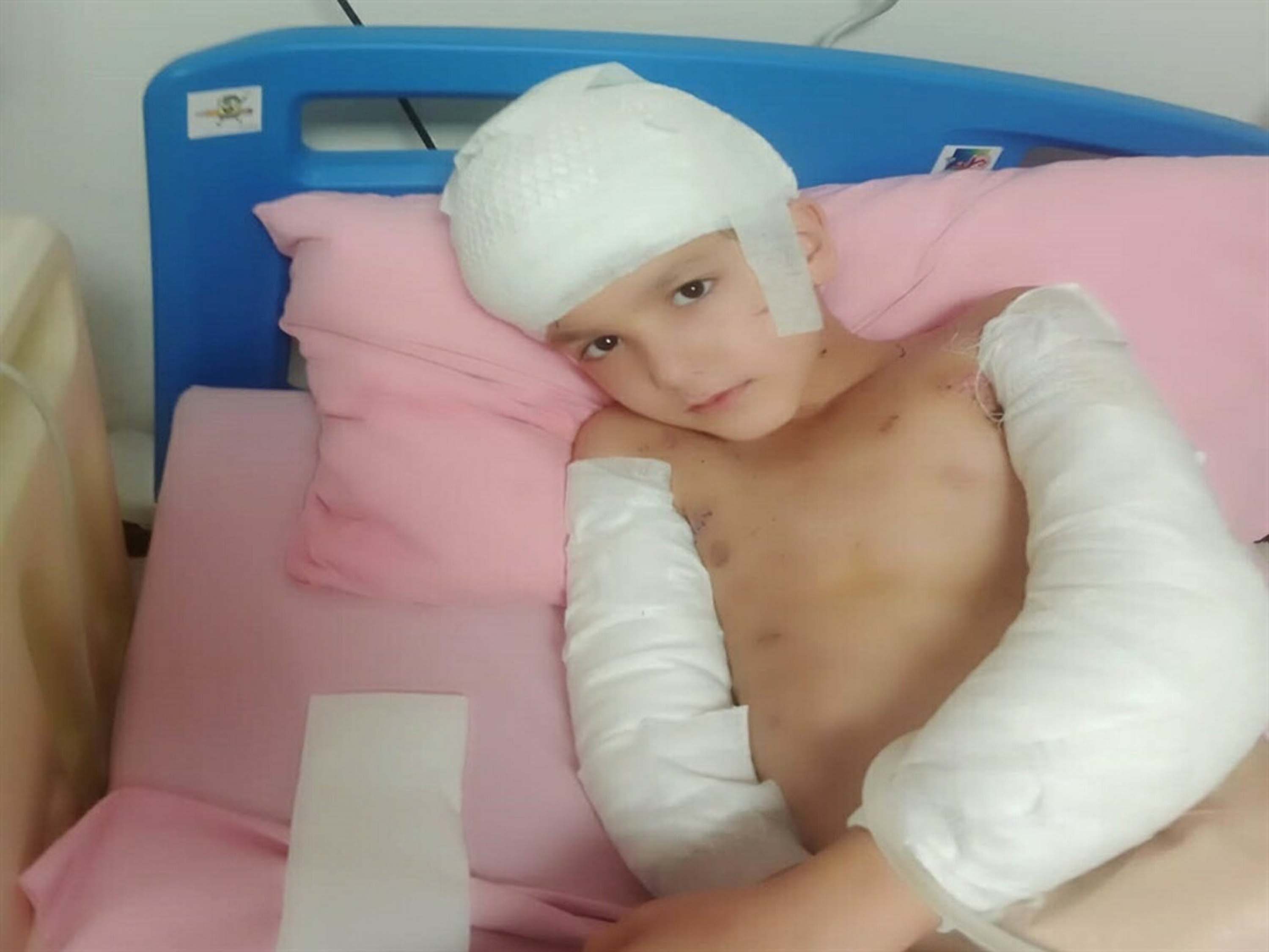 Sokak köpeklerinin saldırısında yaralanan Tunahan'ın ailesine, 5 milyon TL manevi tazminat ödenecek - Görsel 1