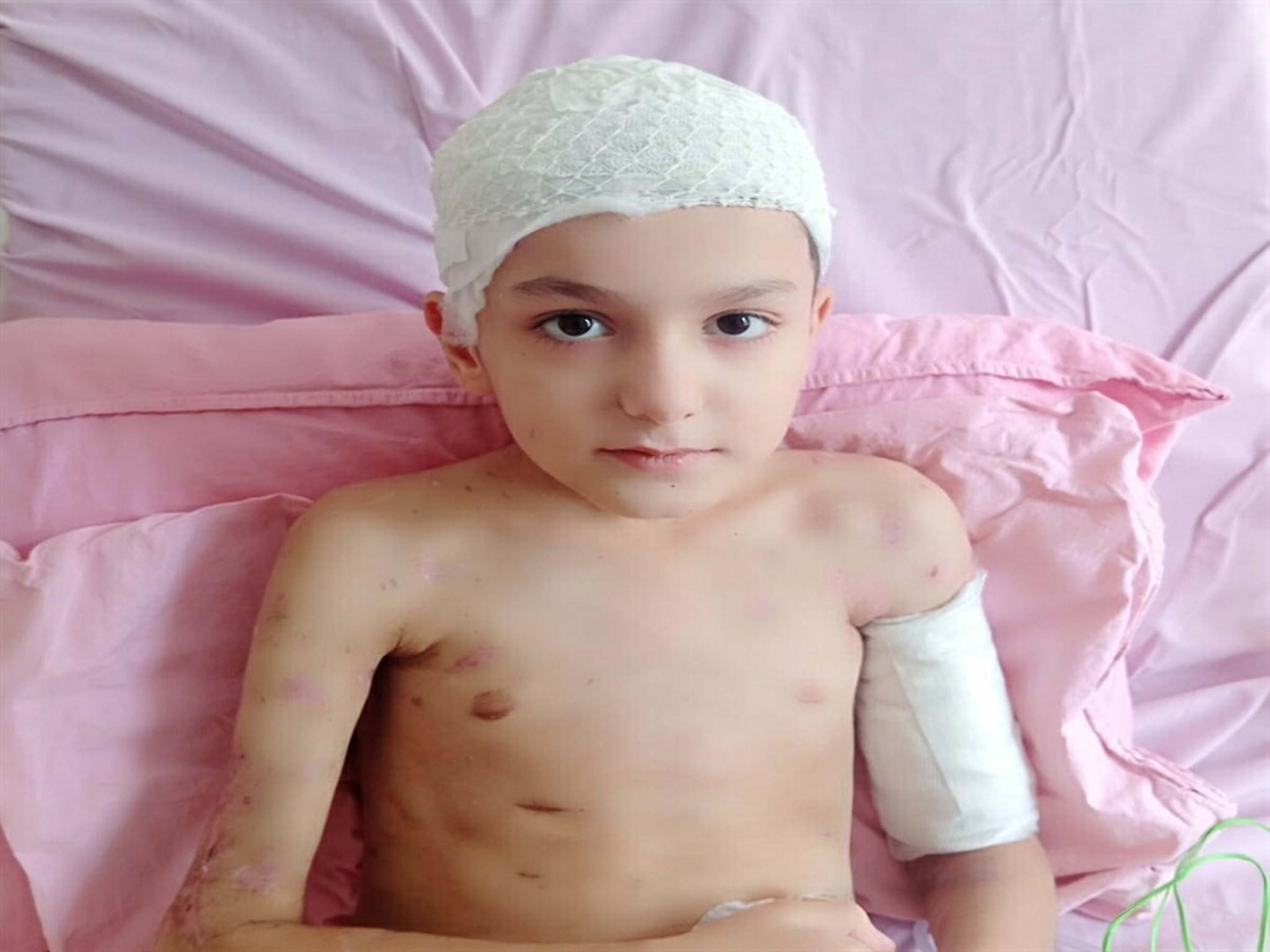 Sokak köpeklerinin saldırısında yaralanan Tunahan'ın ailesine, 5 milyon TL manevi tazminat ödenecek - Görsel 4