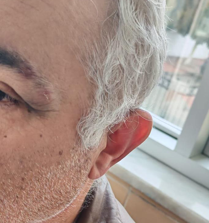 Müezzinin, sıra yüzünden aile hekimini darbettiği iddiası - Görsel 3