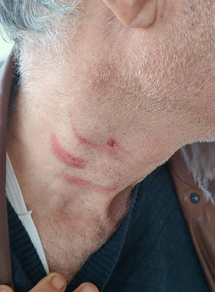 Müezzinin, sıra yüzünden aile hekimini darbettiği iddiası - Görsel 4