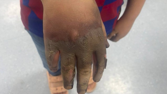 Açıkta bırakılan elektrik panosuna temas eden çocuk elinden yaralandı - Görsel 3