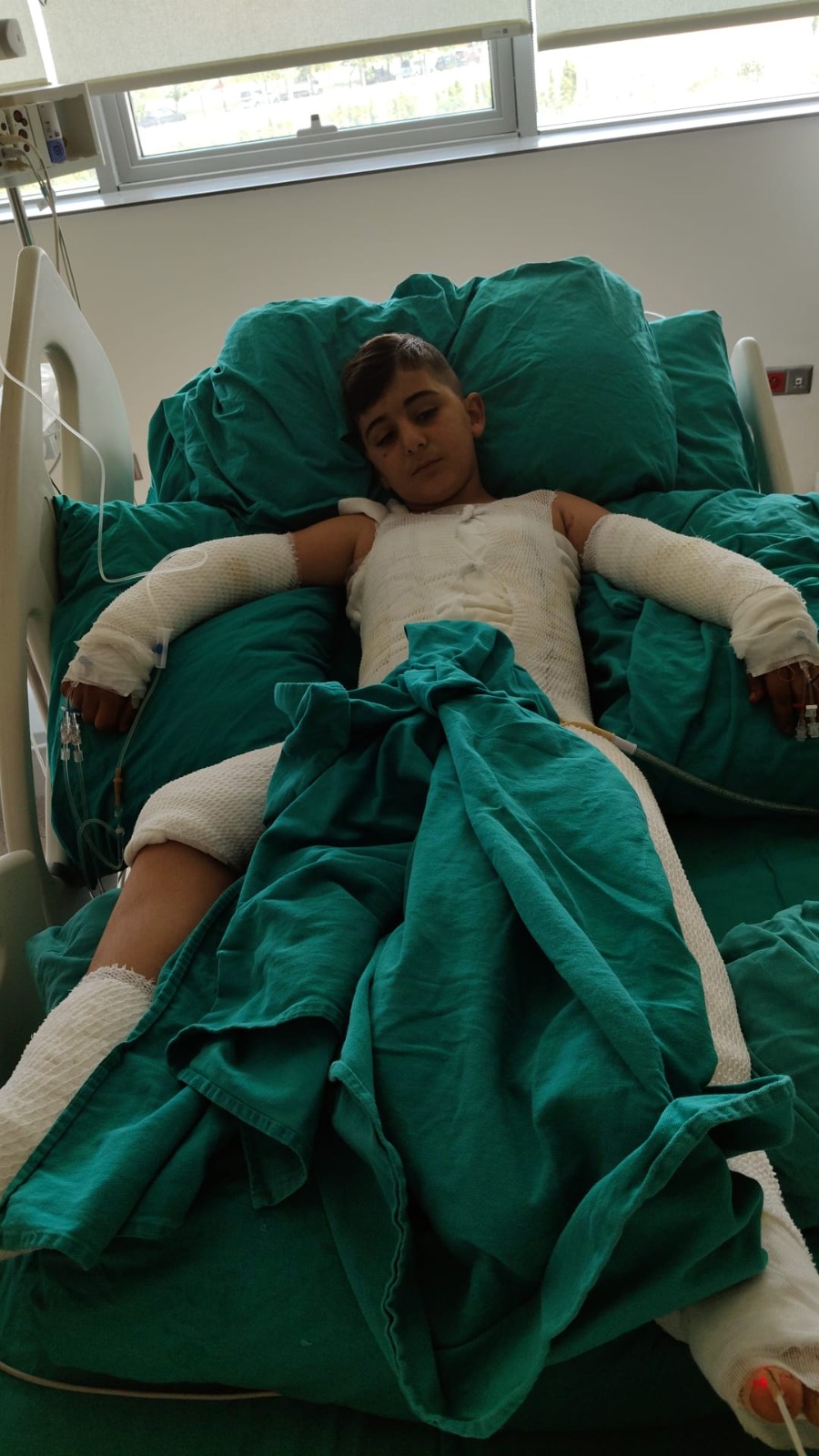 Trafoya takılan uçurtmasını almak isterken akıma kapılan çocuk ağır yaralandı; babadan ihmal iddiası - Görsel 4