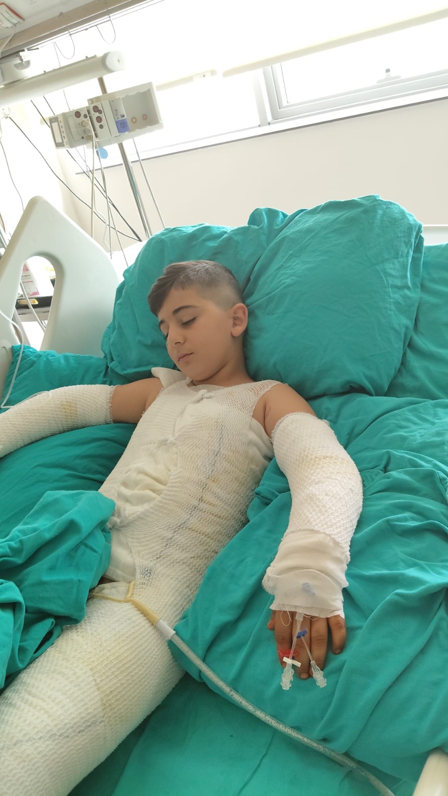 Trafoya takılan uçurtmasını almak isterken akıma kapılan çocuk ağır yaralandı; babadan ihmal iddiası - Görsel 5