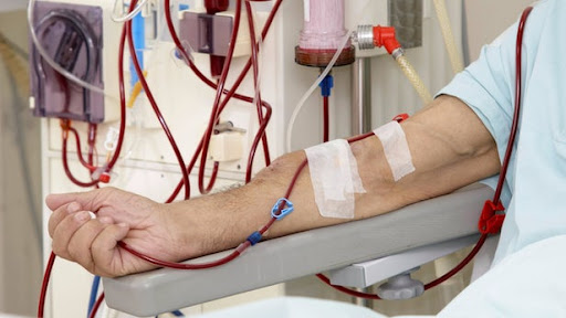 Diyaliz Hastalığının Belirtileri Nelerdir?