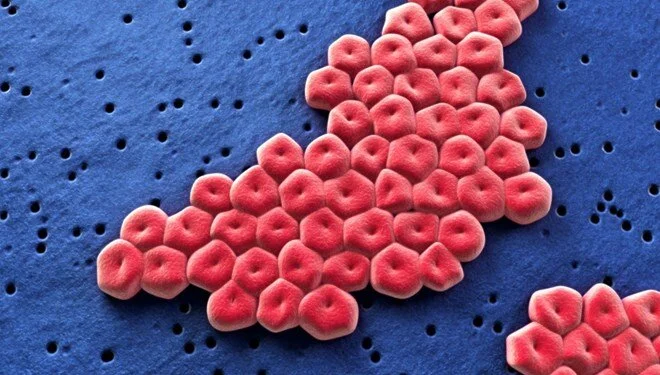 Plastik yiyen süper bakteri hastanelerde yayılıyor