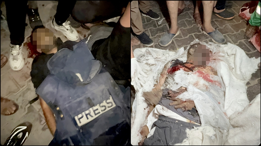 İsrail'in, Şifa Hastanesi yakınlarında gazetecilerin çadırına düzenlediği saldırıda 5 gazeteci öldü