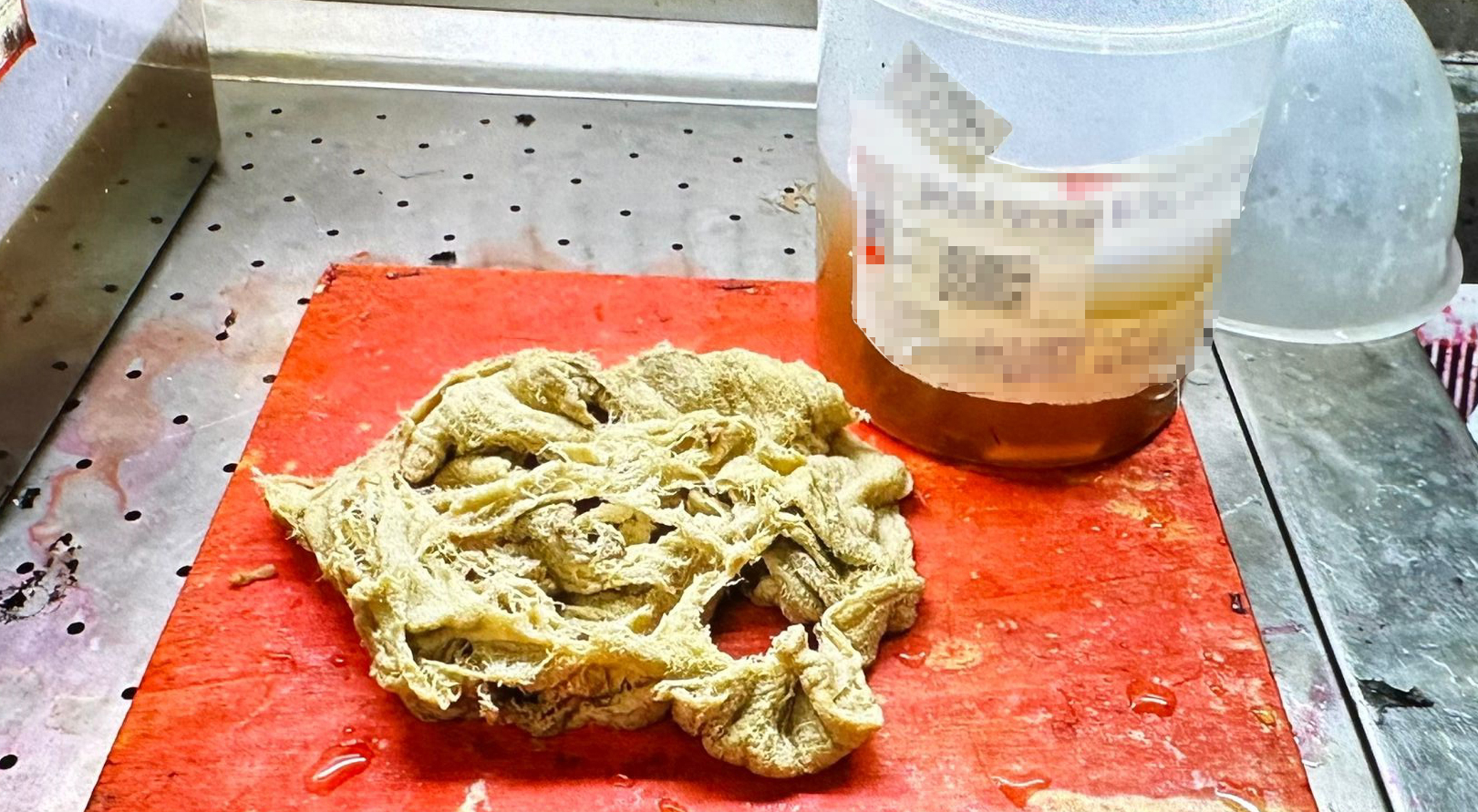 Doğumda unutuldu, iki yıl sonra ortaya çıktı: Gazlı bez ihmaline soruşturma