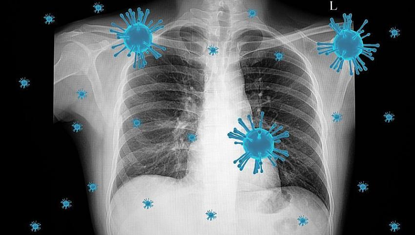 ABD istihbaratı açıkladı! Covid-19 biyolojik silah olarak mı geliştirildi?