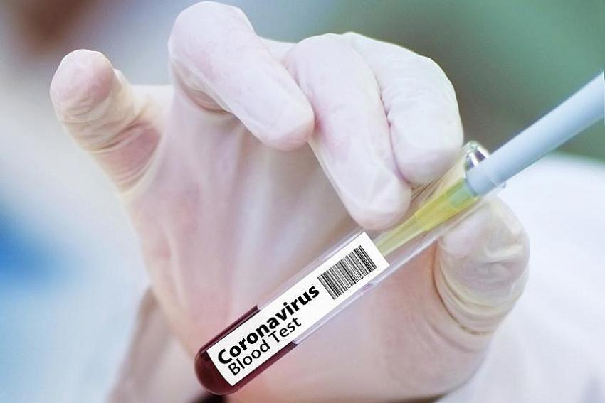 Bakan Koca'dan flaş aşı açıklaması: 50 milyon doz için sözleşme imzaladık