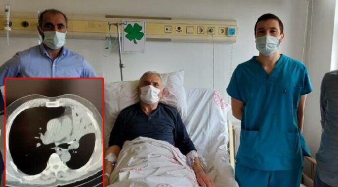 Bolu’da öksürük şikayeti hastaneye  gitti  ciğerinden kemik çıktı