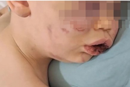 Denizli'deki Çocuğa Yönelik Şiddet Olayı: Anne ve Failin İfadeleri Ortaya Çıktı