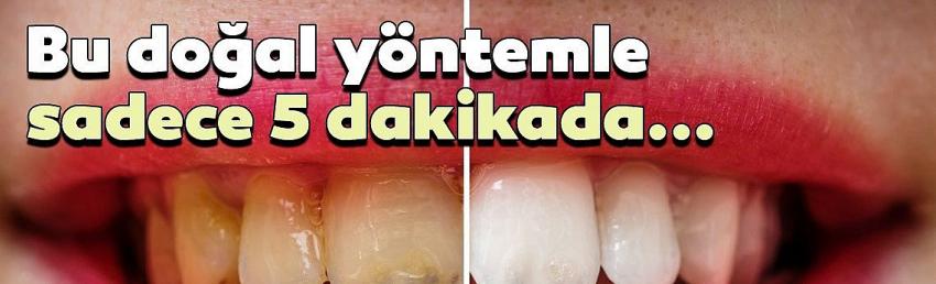 Dişleri beyazlatmak aslında bu kadar kolay! İşte ev yapımı tarifler