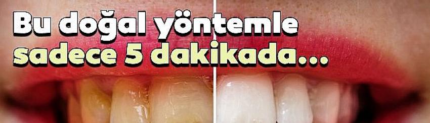 Dişlerinizi beyazlatmak ister misiniz?