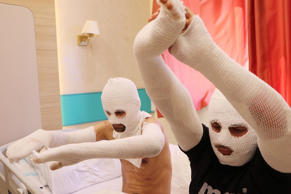 Erzurum'da otomobilde biri çakmağına gaz doldururken diğeri sigara yakmaya kalkan iki arkadaş hastanelik oldu