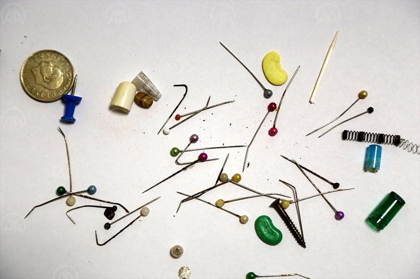 Göğüs cerrahının yanlışlıkla yutulan cisimlerden oluşan koleksiyonunda toplu iğneler başı çekiyor