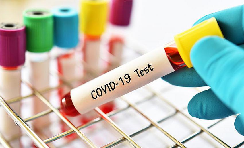 İtiraf gibi Covid-19 açıklaması! Kitlerin doğruluğu güvenilir mi?İtiraf gibi Covid-19 açıklaması! Kitlerin doğruluğu güvenilir mi?