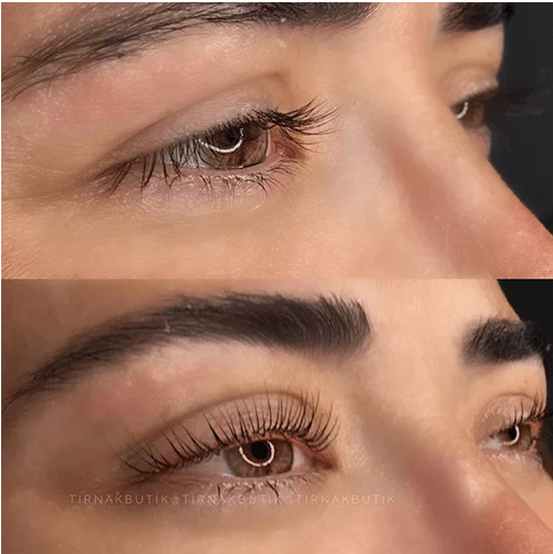 Kirpik Lifting Nedir?