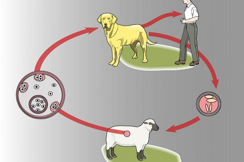 Kistik Ekinokokkoz (Kist Hidatik) 