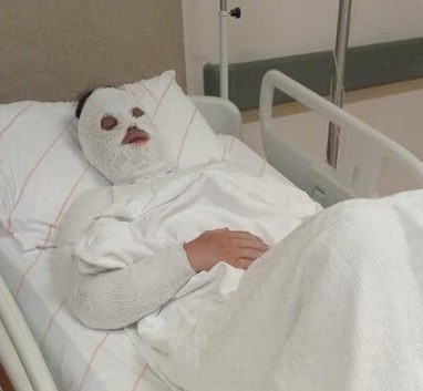 Konya'da eski nişanlısının yüzüne kimyasal sıvı atan sanığa 15 yıl hapis cezası