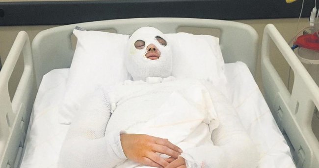 Konya'da eski nişanlısının yüzüne kimyasal sıvı atarak yaralayan sanık hakim karşısında