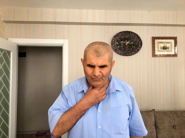 Konya’da görme engelli hafızın kayınbiraderleri tarafından darp edildiği iddiası