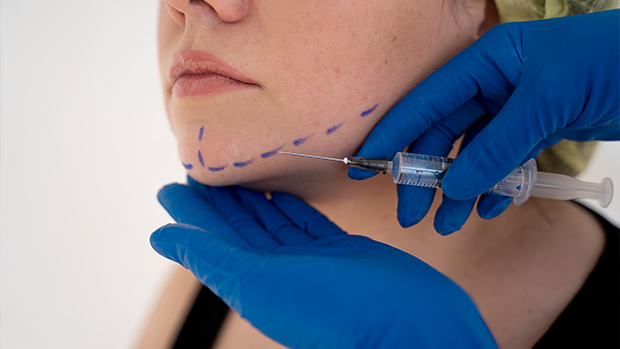 Nazolabial Dolgu Ne Zaman Yapılır?