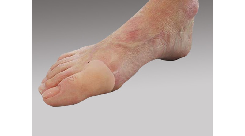 Protez Ayak Bakımı Nasıl Yapılır?
