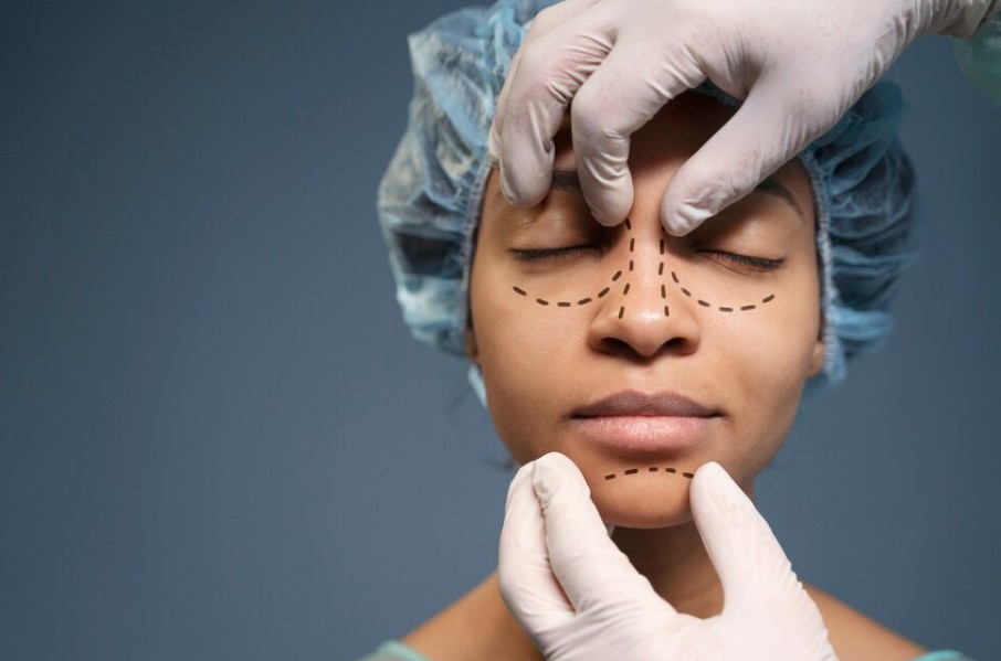 Seçkin Ulusoy'un Burun Estetiği Deneyimleriyle Daha İyi Bir Görünüm