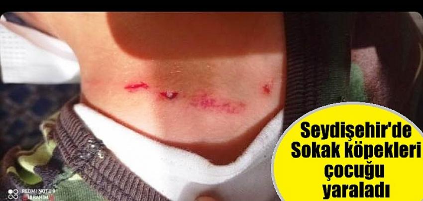 Seydişehir'de Sokak köpekleri çocuğu yaraladı