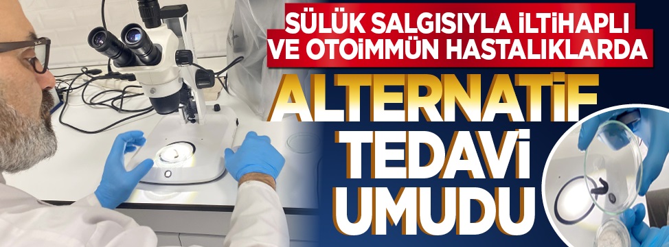 Sülük salgısıyla iltihaplı ve otoimmün hastalıklarda alternatif tedavi umudu